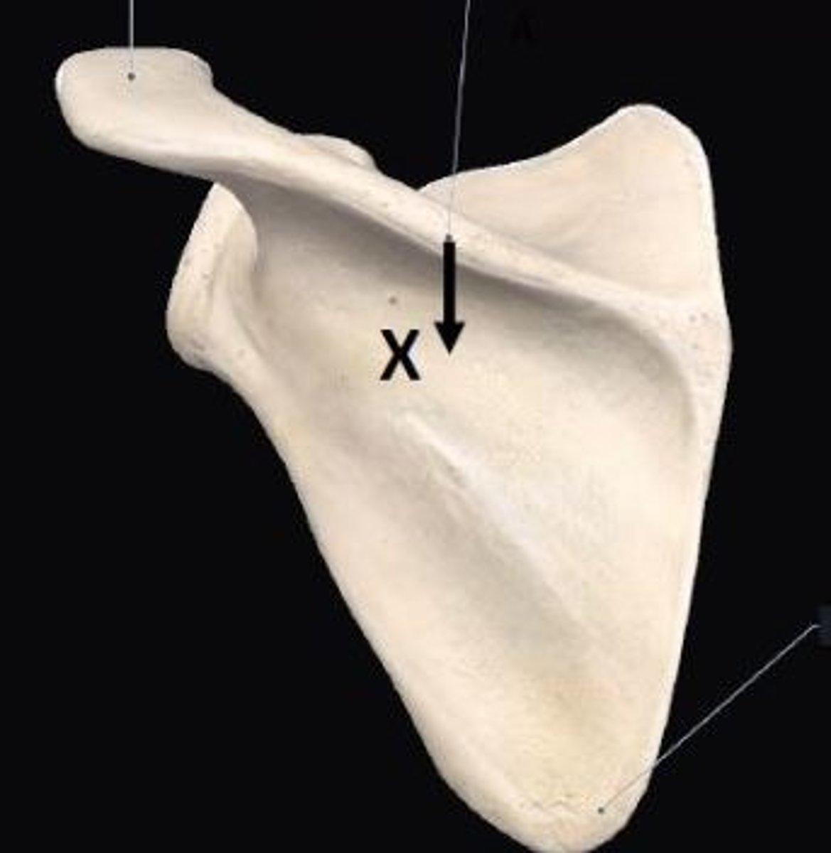 <p>How do you classify this bone shown in this image?</p>
