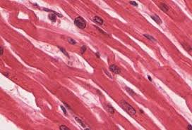 <p>Striated, branched involuntary muscle of the heart with intercalated discs.</p>