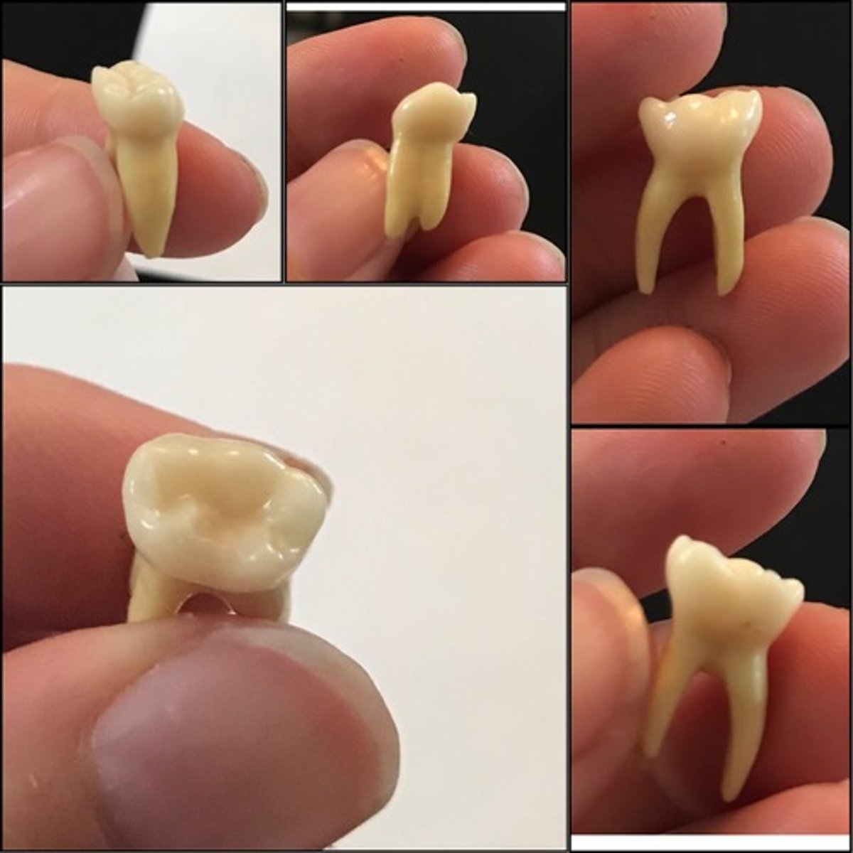 <p>What tooth is this ?</p>