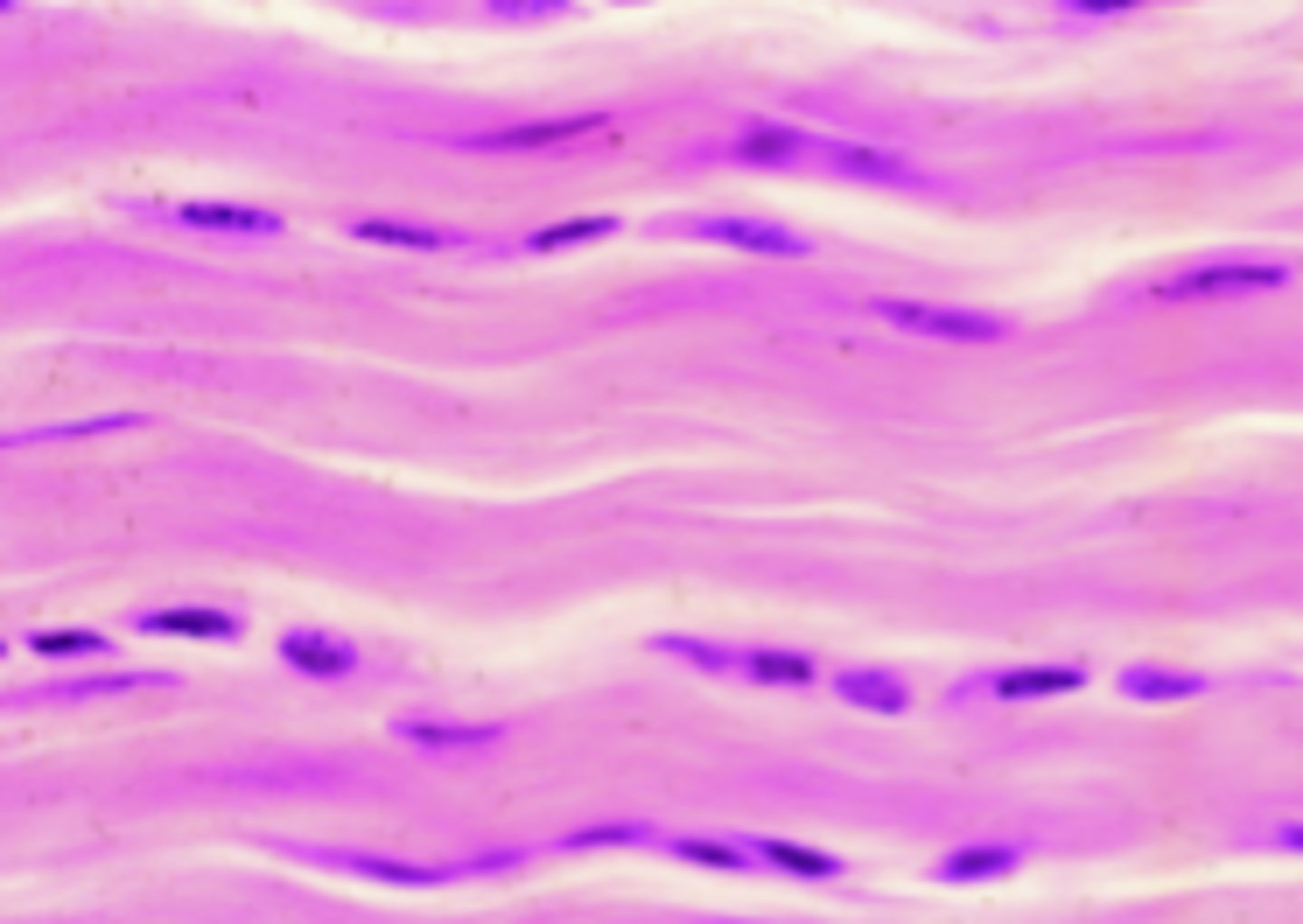 <p>What tissue type is this?</p>