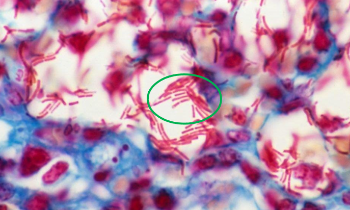 <p>What bacteria is this?</p>