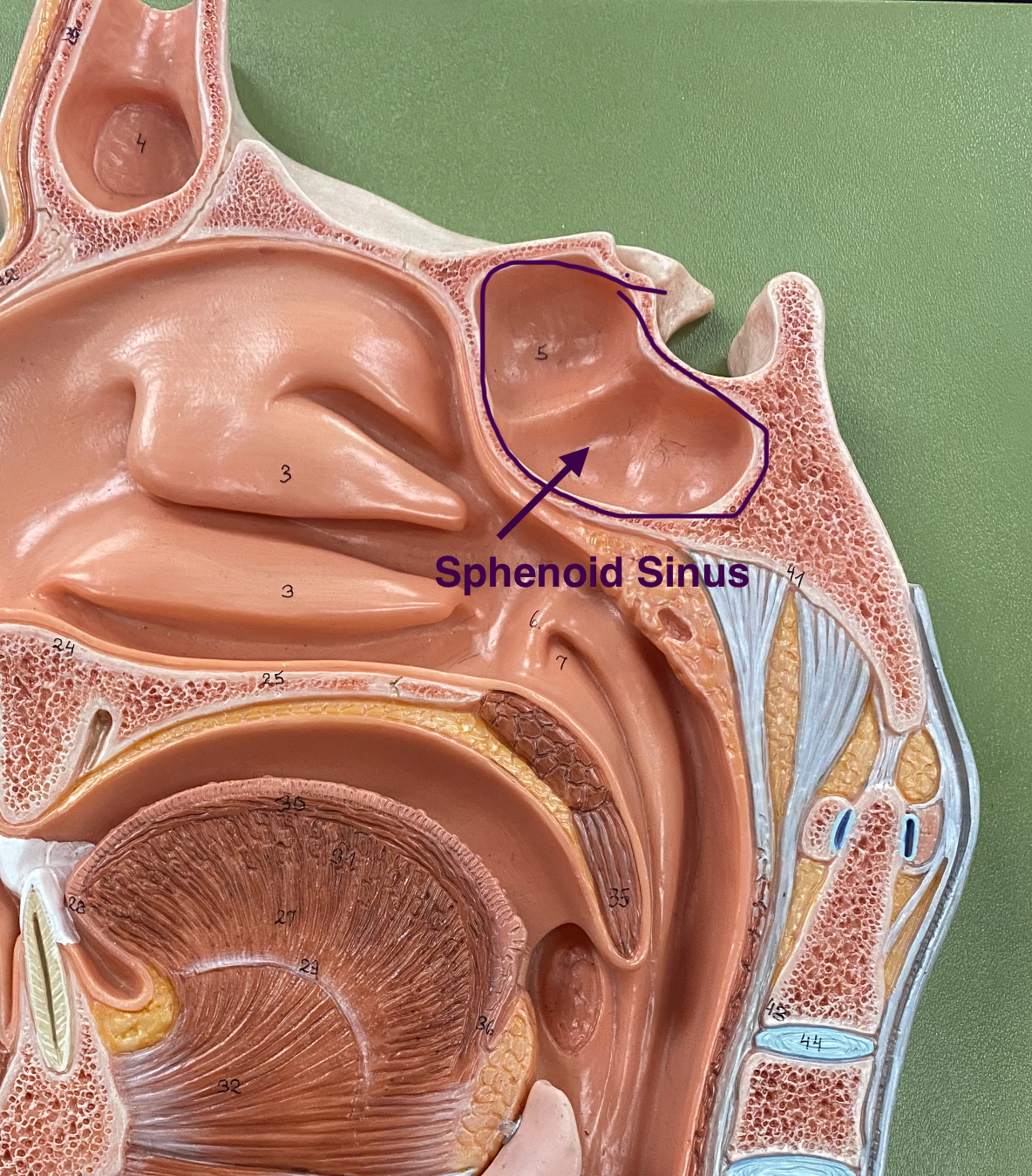 <p>located within the sphenoid bone, deep behind the nasal cavity. Air-filled cavity that drains into the nasal cavity and helps lighten the skull. Aid in filtering inhaled air.</p>