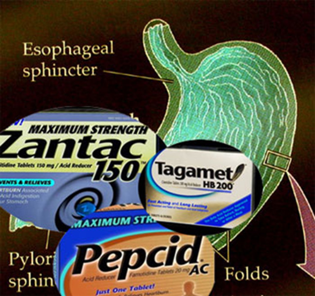 <p>- histamine 2 receptor antagonism, selective H2 specific blockade that decreases HCL (Ach and gastrin still present) </p><p>- drugs: Ranitidine (Zantac) which does not cross BBB, Cimetidine (Tagamet), Famotidine (Pepcid) </p><p>- quick relief for acute tx </p>
