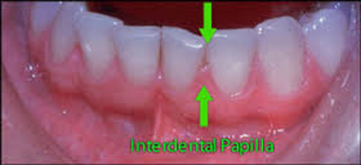 <p>interdental gingiva - projection of gingiva (gum tissue) between the teeth</p>