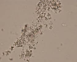 <p>Only different between amorphous urates and phosphate is the ph</p>