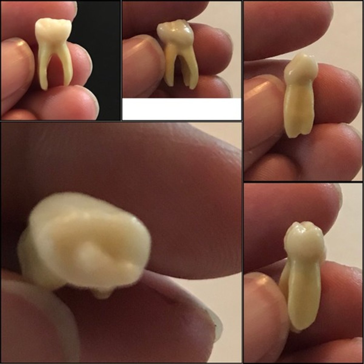 <p>What tooth is this ?</p>