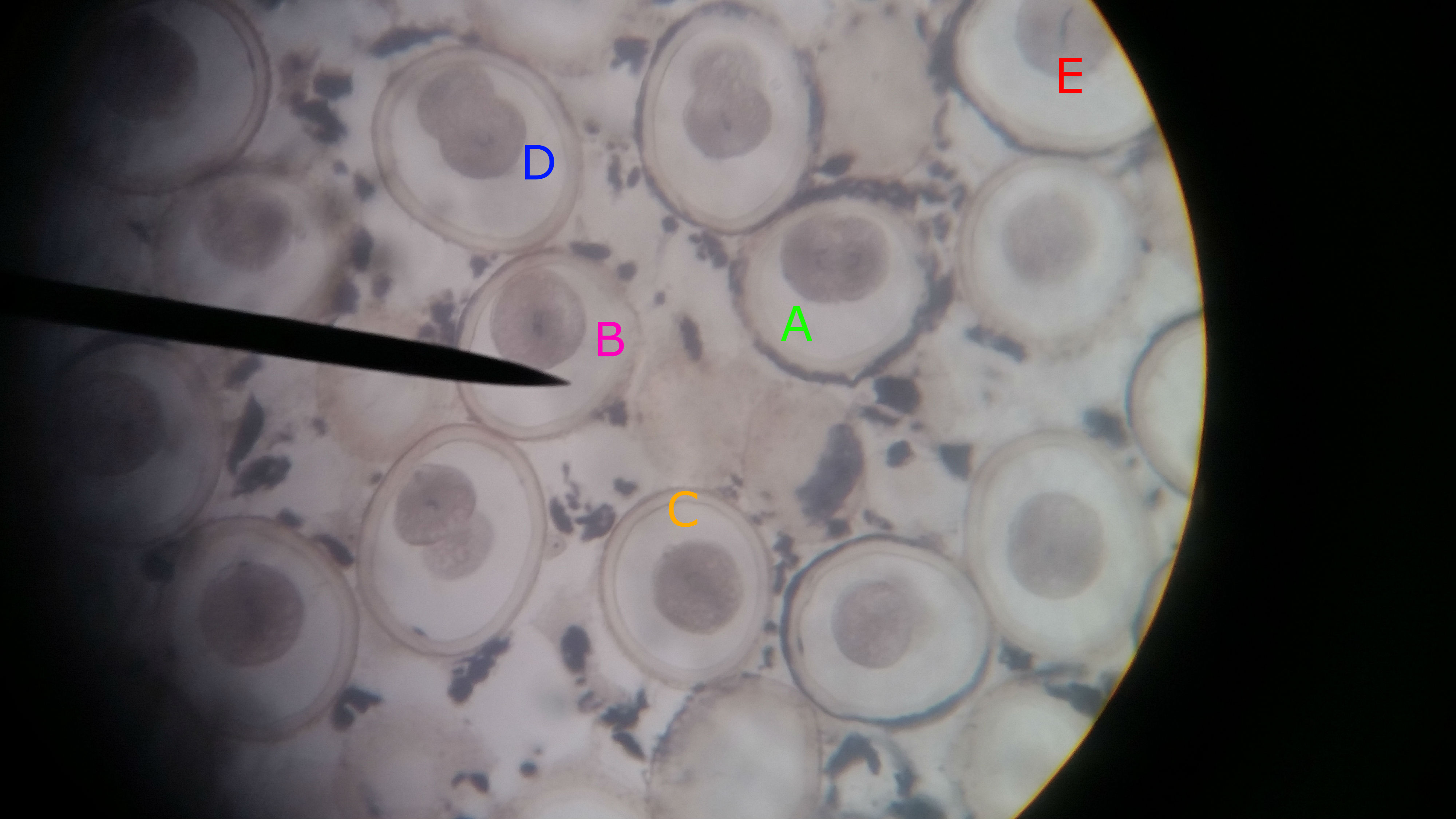 <p>Which of the following phases of mitosis is shown in cell A?</p>