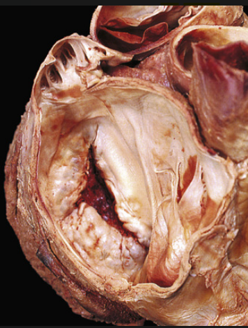 <p>What is this? (atrium wise)</p>