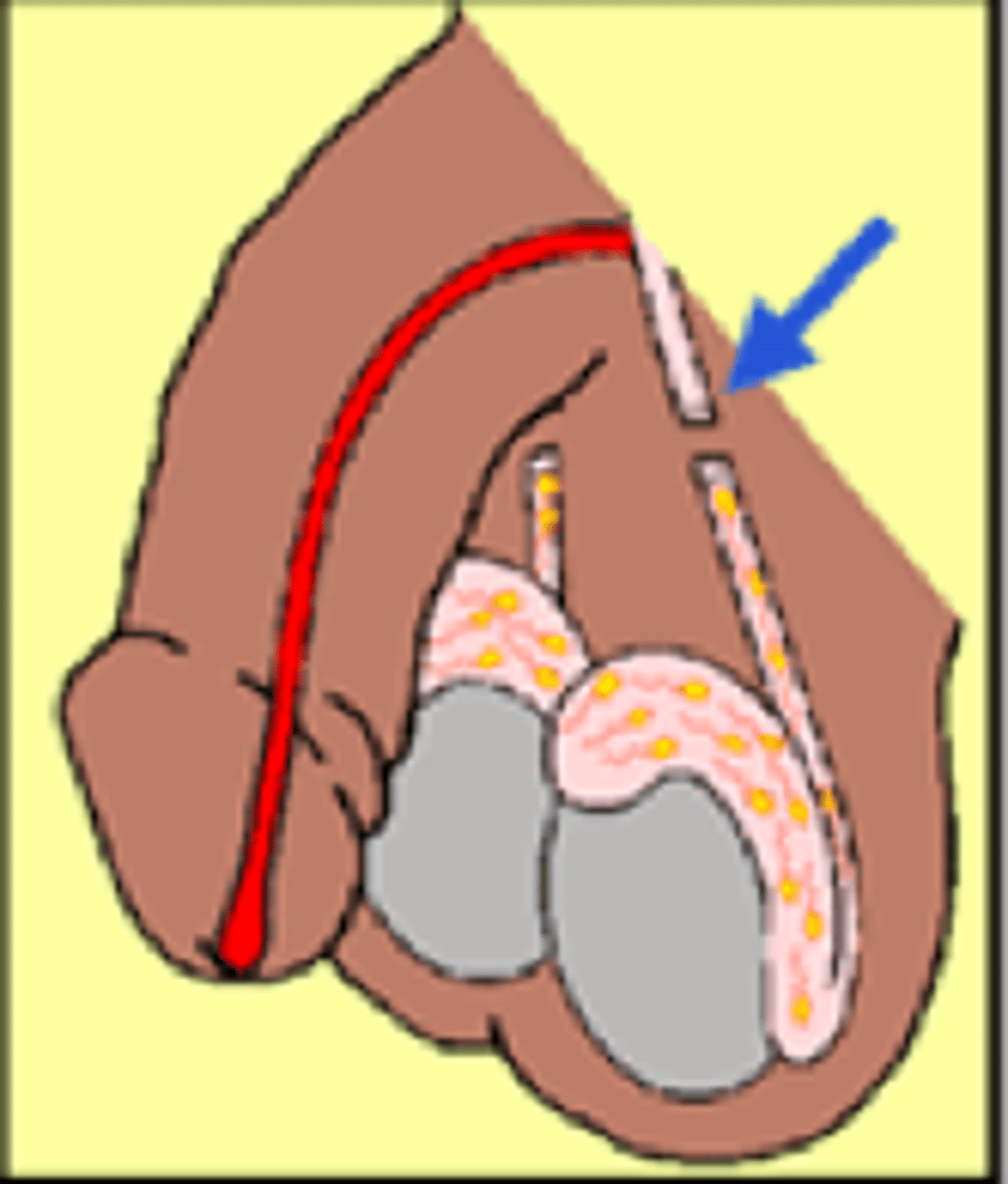 <p>removal of a segment of the vas deferens to produce sterility in the male</p>