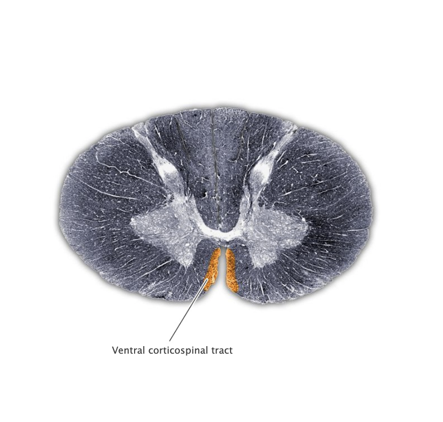 <p>Ventral corticospinal tract</p>