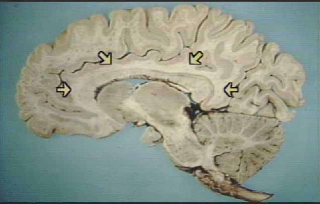 <p>What are the arrows pointing at?</p>