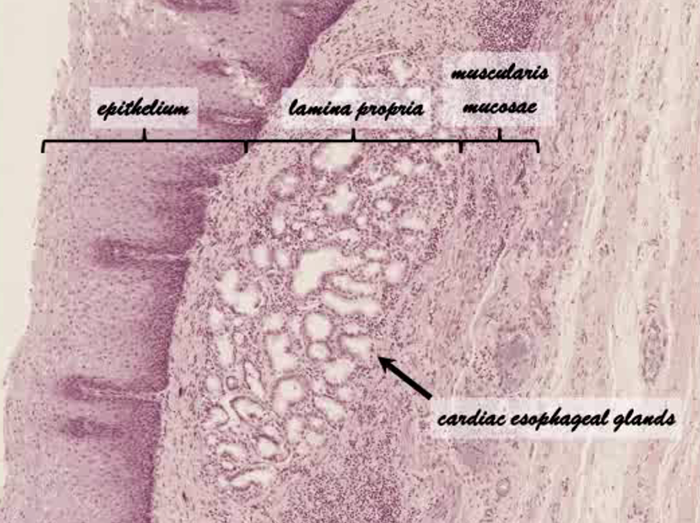 <p>What region of the esophagus is this? </p>
