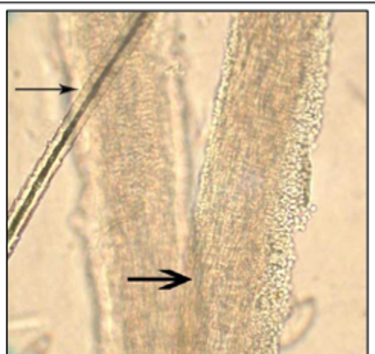 <p>Photomicrograph of a 10% KOH wet mount of an infected hair from a case of ringworm in a cow.</p><p>The most likely dermatophyte in cattle is ____________</p>