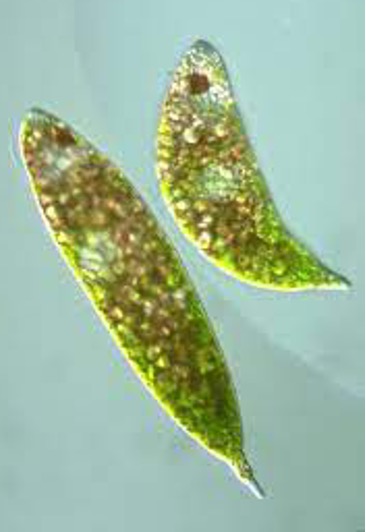 <p>What member from Excavata group is this?</p><ul><li><p>Unicellular</p></li><li><p>Has a:</p><ul><li><p>Flagellum</p></li><li><p>Nucleus</p></li><li><p>Chloroplasts</p></li><li><p>Contractile vacuole</p></li><li><p>Eyespot</p></li></ul></li></ul>