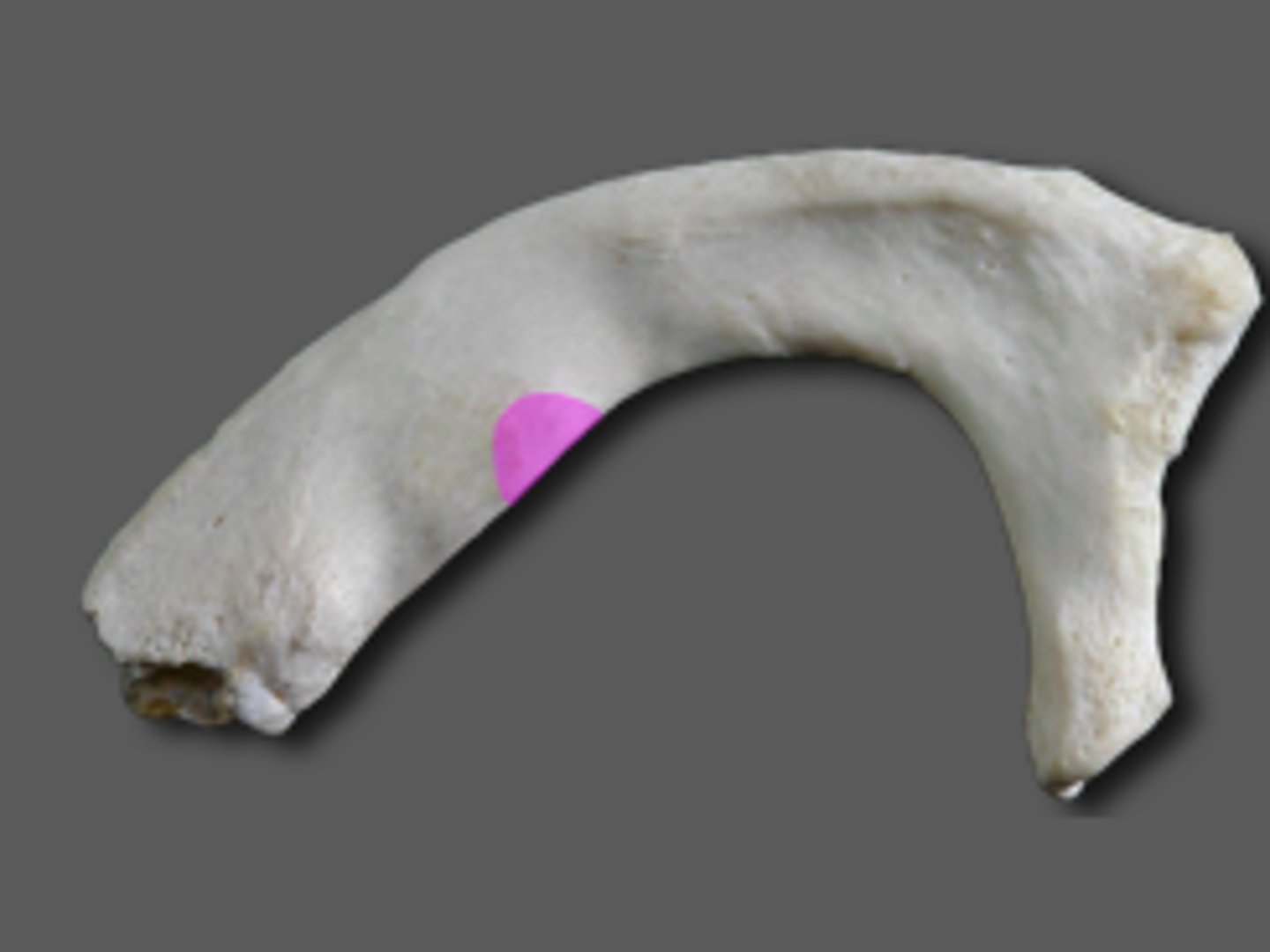 <p>anterior scalene insertion</p>