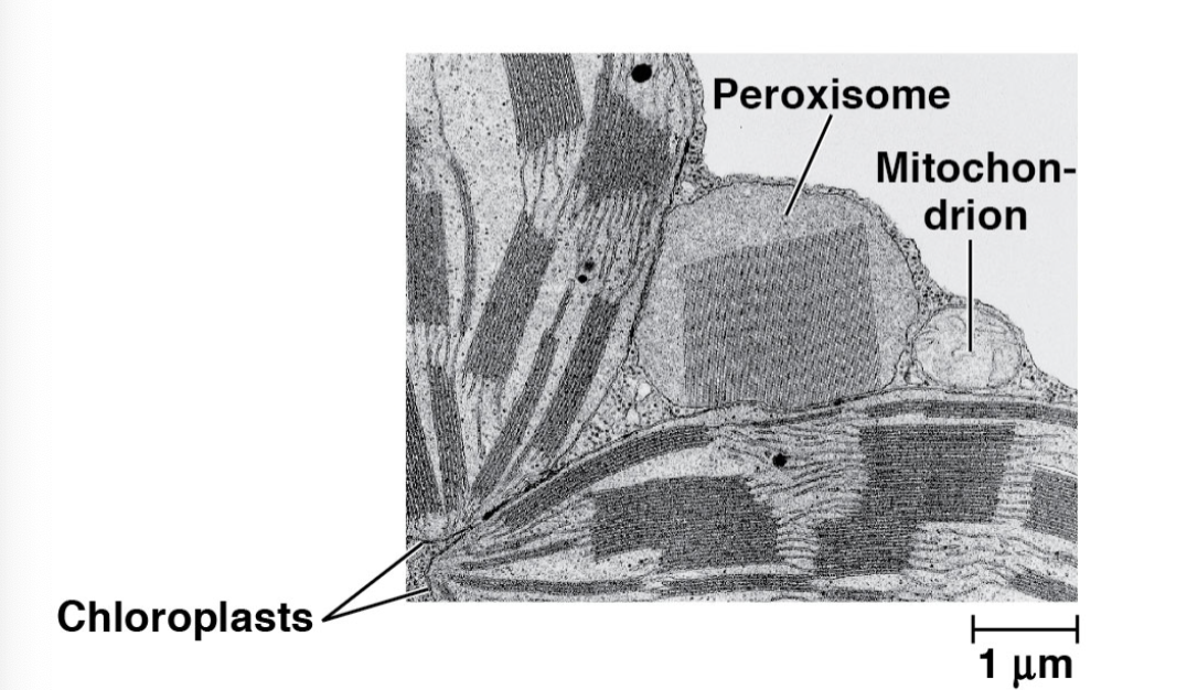 <p>Peroxisomes</p>