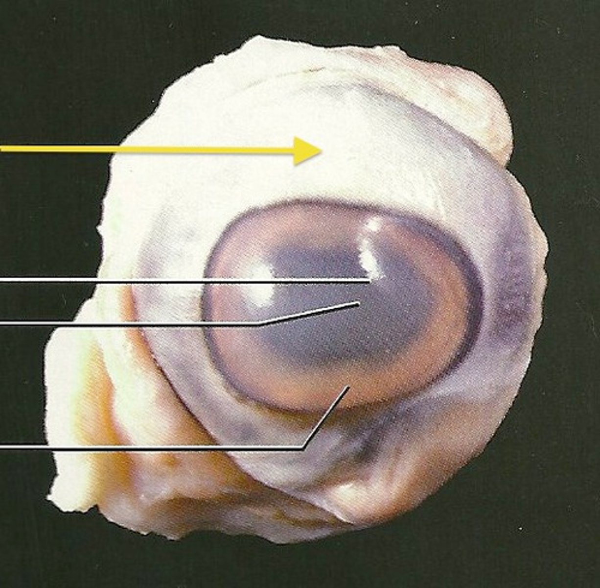 <p>Tough, white outer coat of the eyeball</p>