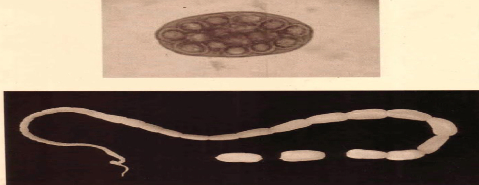 <p>Parasite under microscope </p>