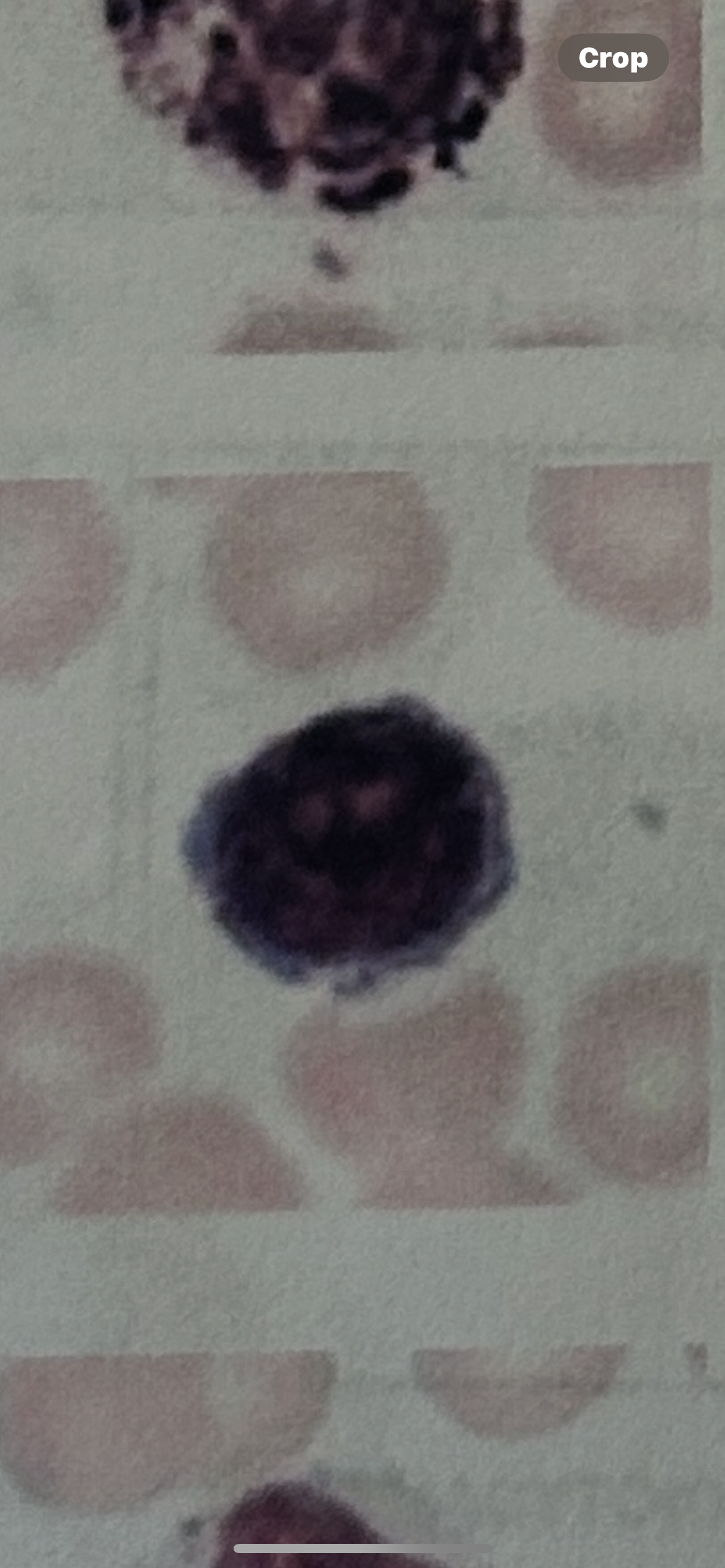 <p>wbc</p>