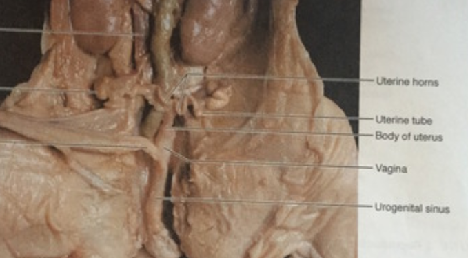 <p>muscular canal that connects the cervix (the lower part of the uterus) to the outside of the body, serving as the birth canal and the pathway for menstrual flow.</p><p></p>