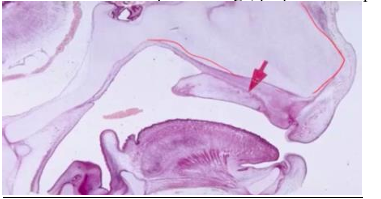 <p>-form nasal septal cartilage, perpendicular plate of ethmoid, crista galli of ethmoid</p>