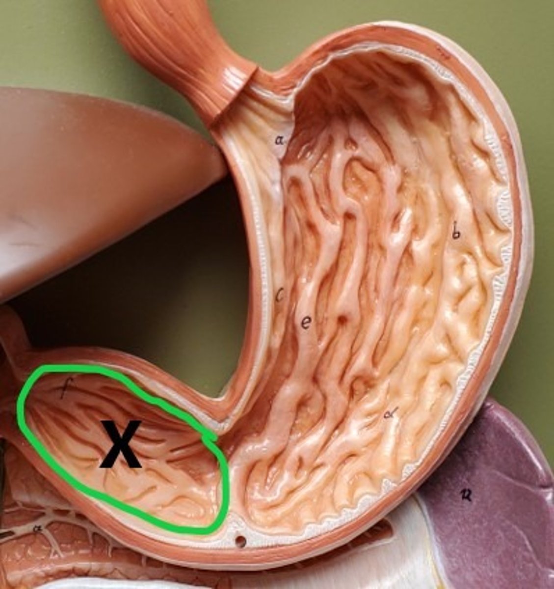 <p>ID the Region of the Stomach</p>