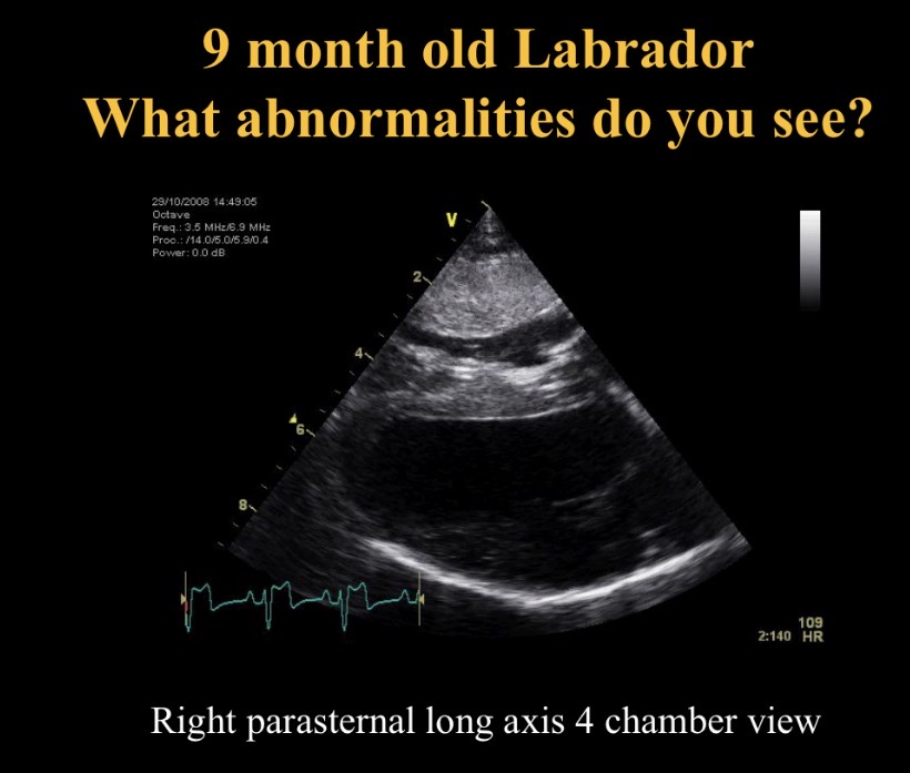 <p>Abnormality seen + causes </p>