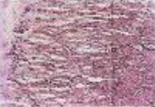 <p>Identifica el tejido</p>