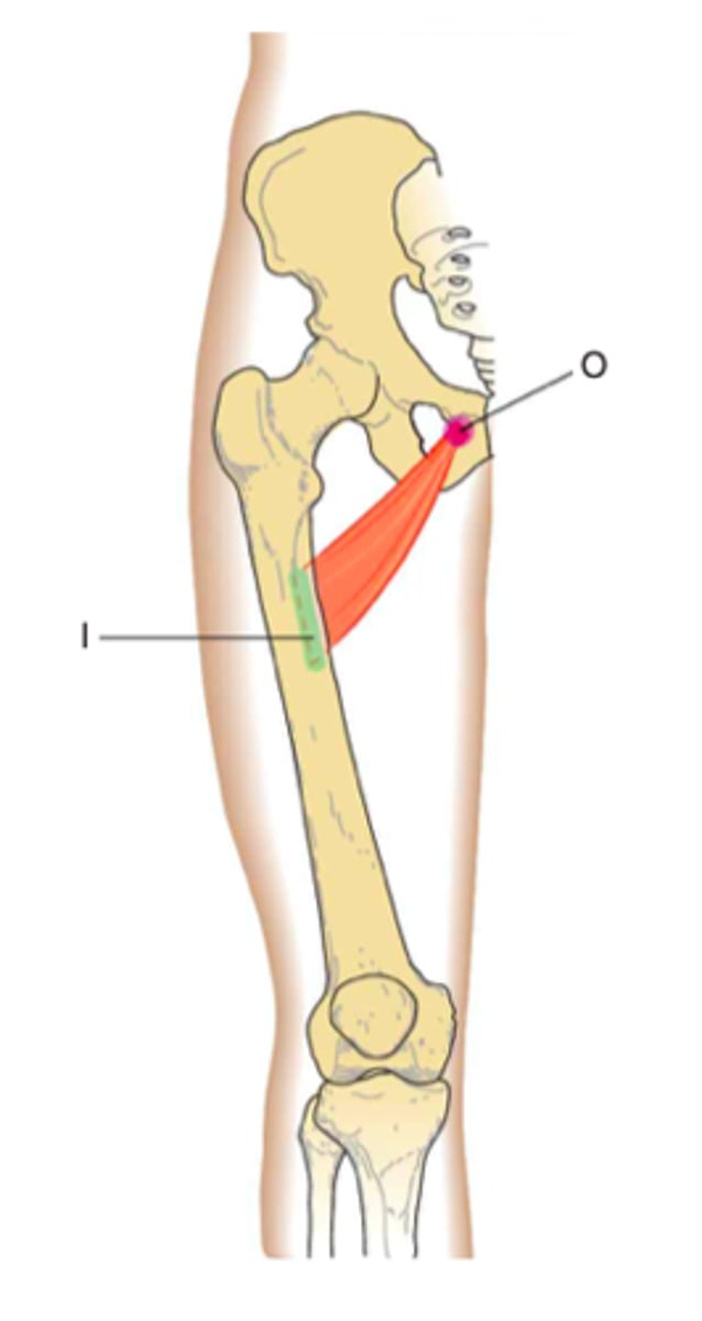 <p>shaft of femur, between pectineus and adductor longus</p>
