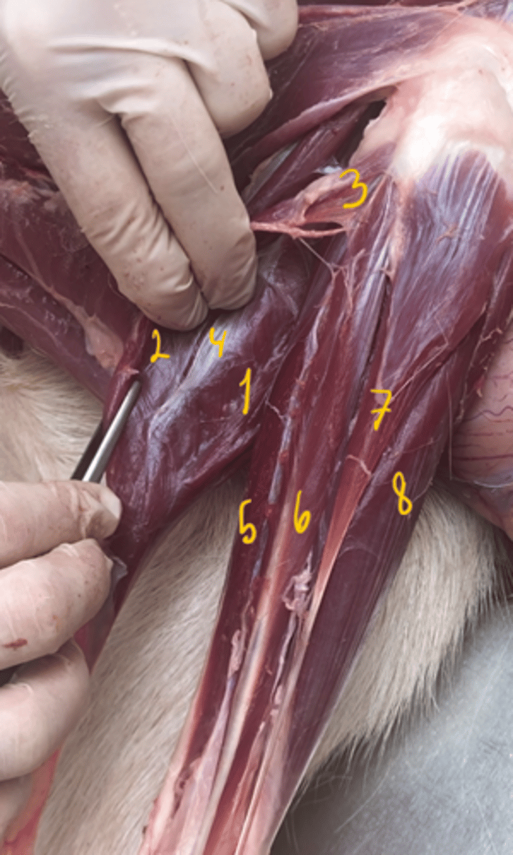 <p>identify muscles. What muscle is absent?</p>