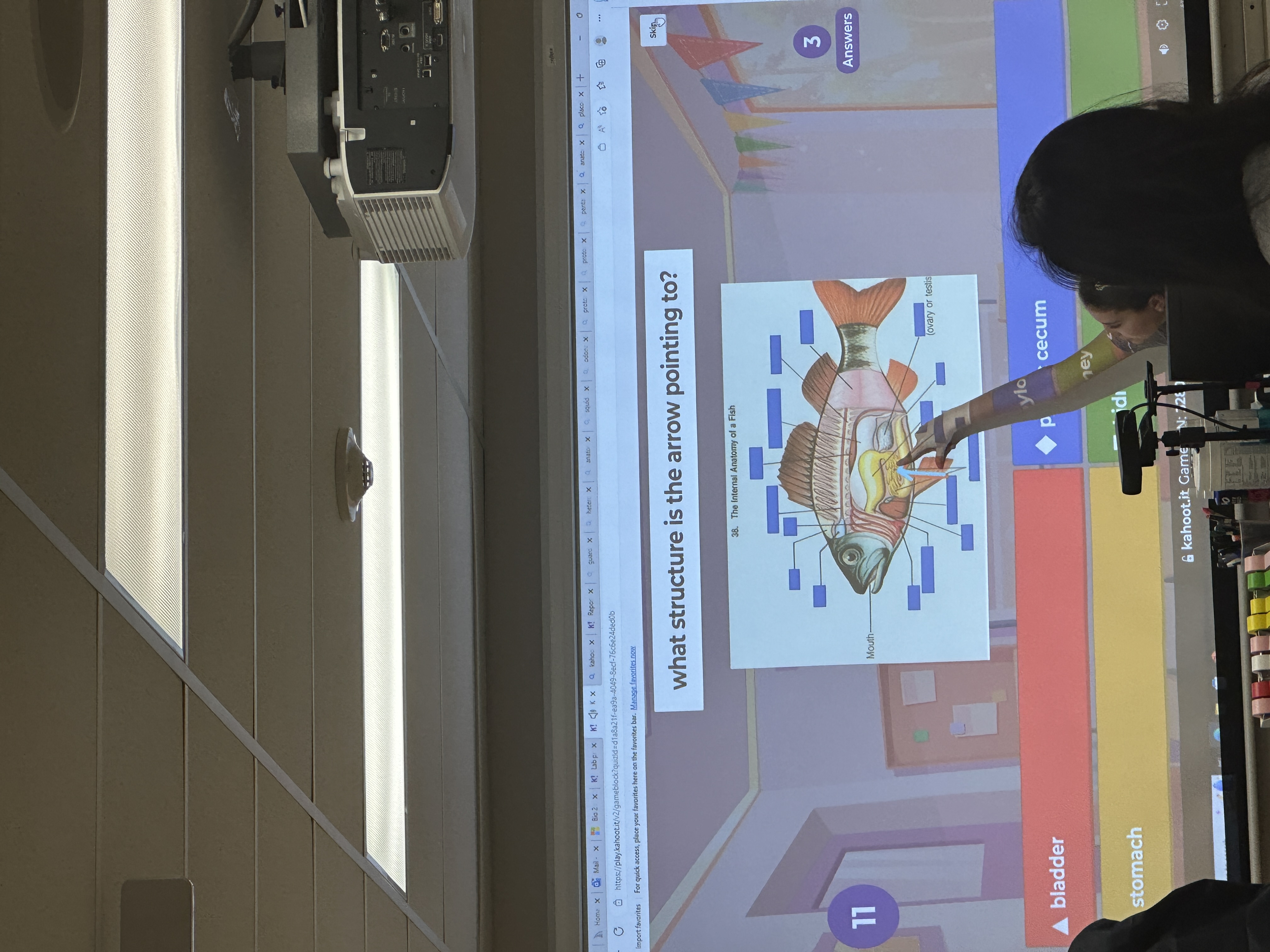 WHAT STRUCTURE IS THE ARROW POINTING TO?