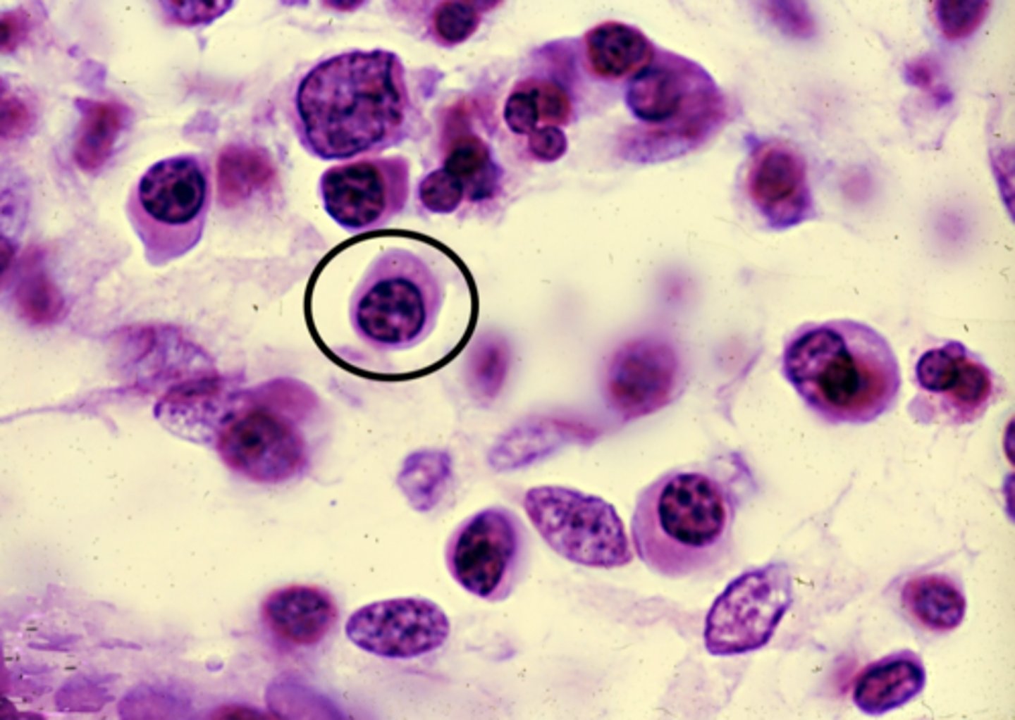 <p>what cell type is circled?</p>