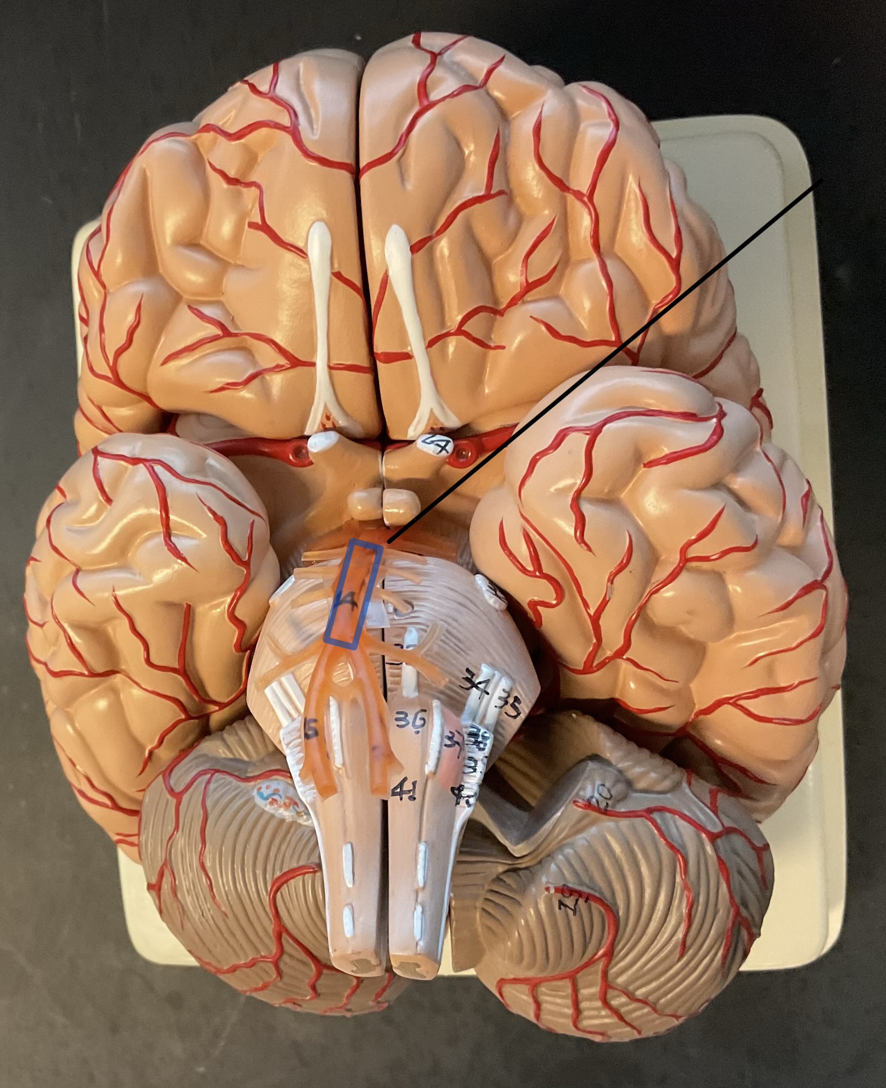 <p>Name this artery that feeds into the brain.</p>