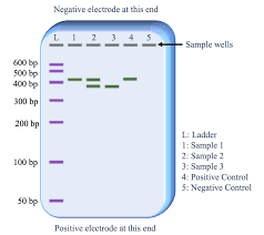<p>Gel Electrophoresis</p>