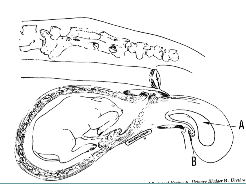 <p>grade 3: vagina, cervix, and bladder prolapse</p><p>grade 4: progression of grade 3, leads to necrosis or fibrosis</p>
