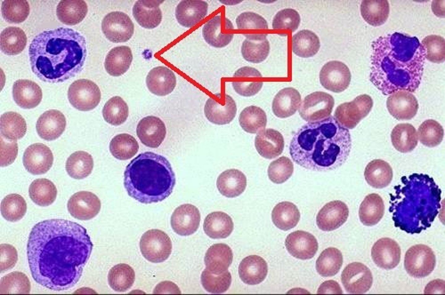 <p>platelets. helps in wound healing</p>