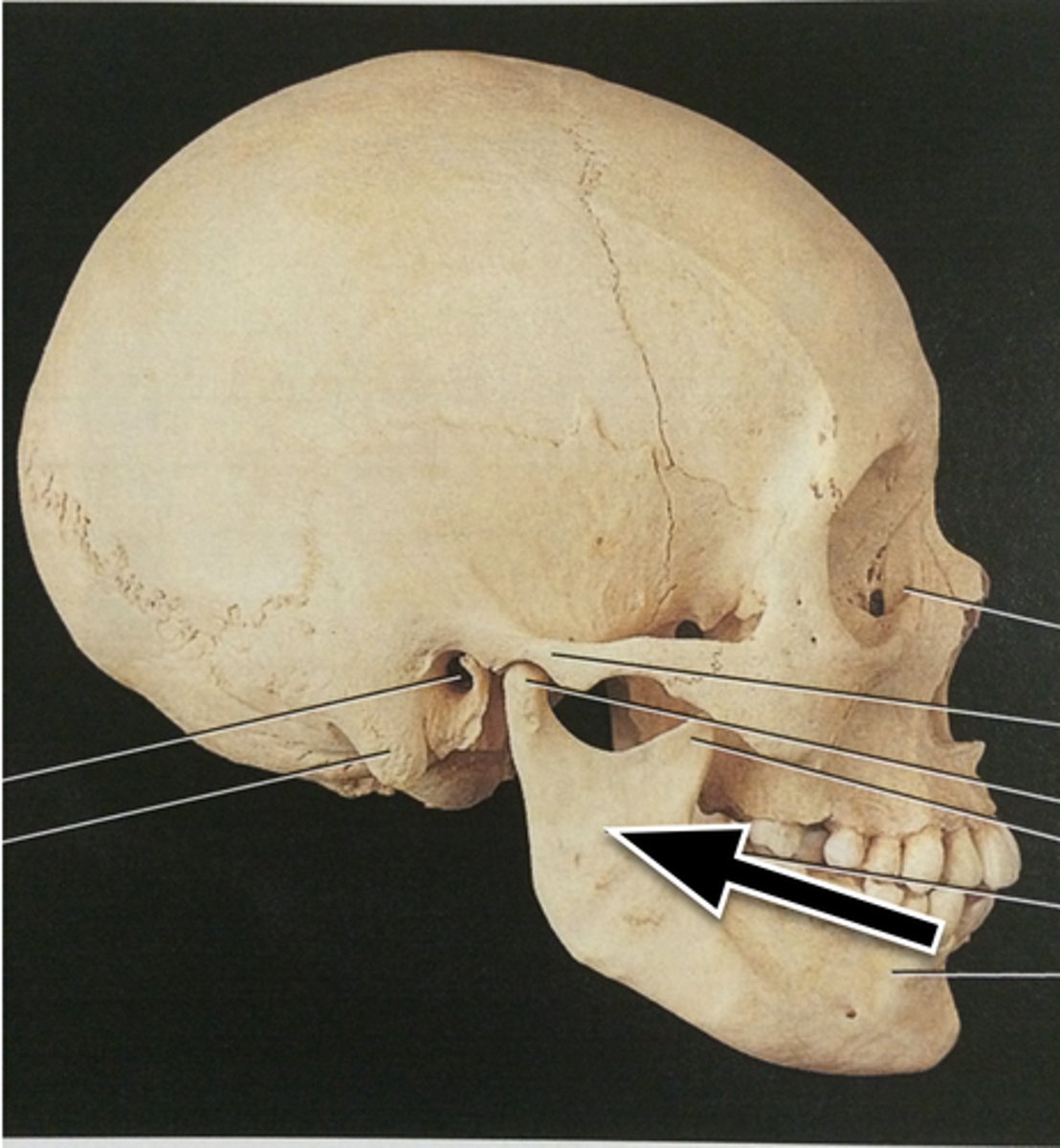 <p>vertical part of mandible</p>
