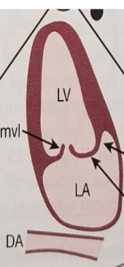 <p>What is the right arrow point to?</p>