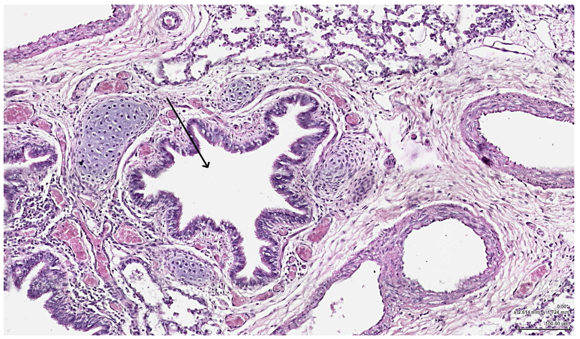 <p><span><span>Right before passing through the indicated structure, where would air most likely travel?</span></span></p>