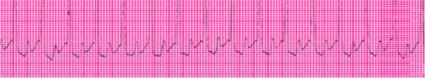 <p>Name this rhythm.</p>