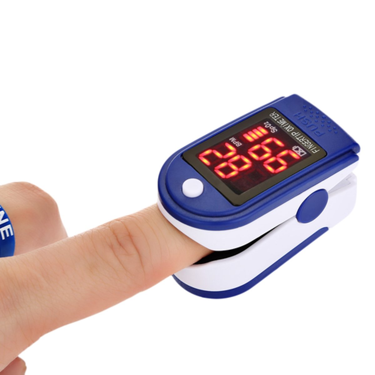 <p>- their O2 carrying capacity is lost</p><p>- loss of protein &amp; albumin</p><p>- lost platelets and other clotting factors</p>