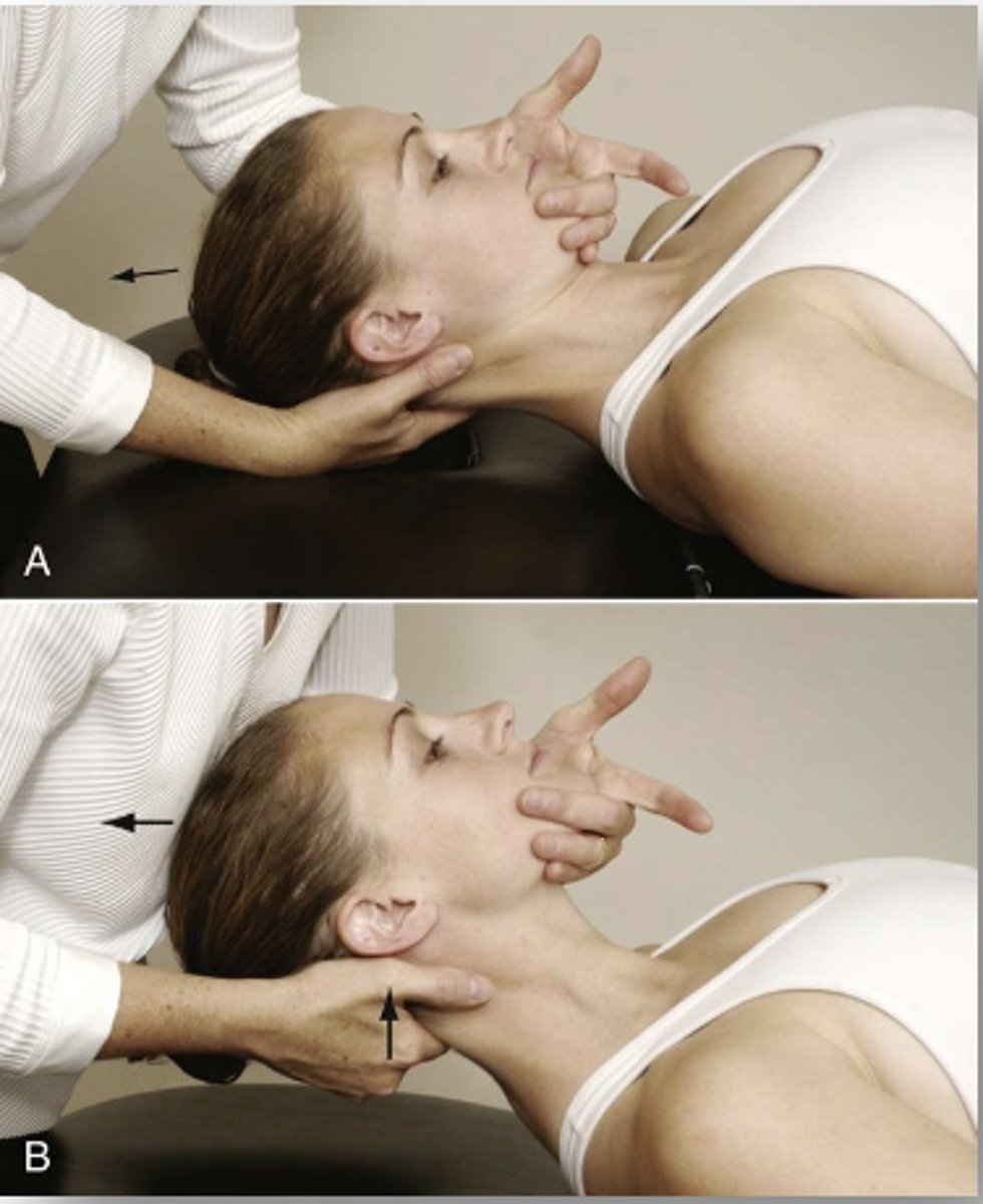 <p>- step 1: apply general traction to the entire cervical region</p><p>- step 2: if negative, apply traction with CV flexion</p><p>- step 3: if negative, stabilize C2 with CV flexion, apply traction</p><p>- (+) = soft end feel, reproduction of sxs, apprehension</p>