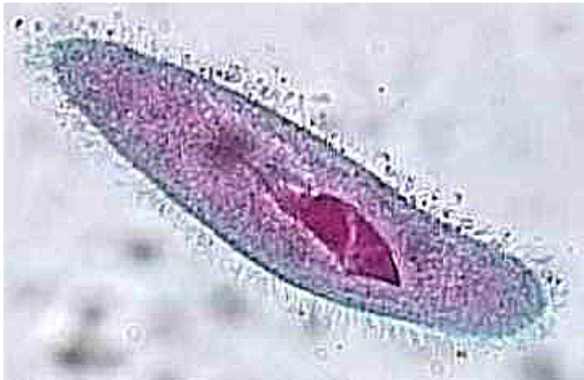 <p>What is this organism? What is the purple circle inside called?</p>