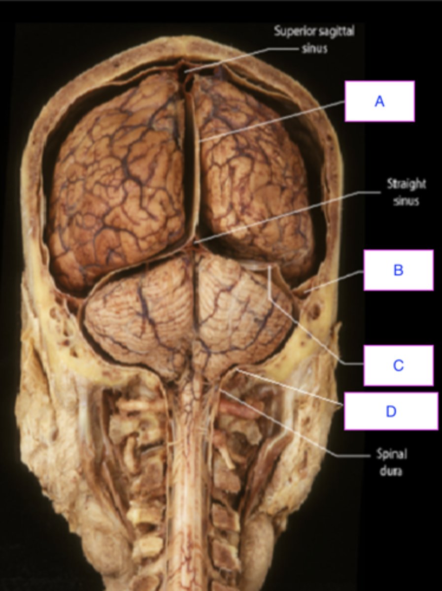 <p>ID meninges (C)</p>