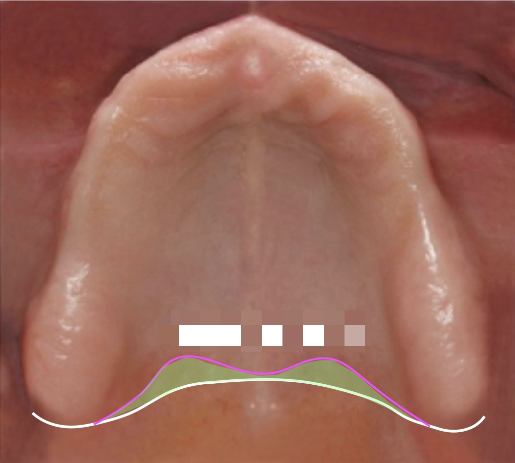 <p>what structure is demonstrated by the green highlight?</p>