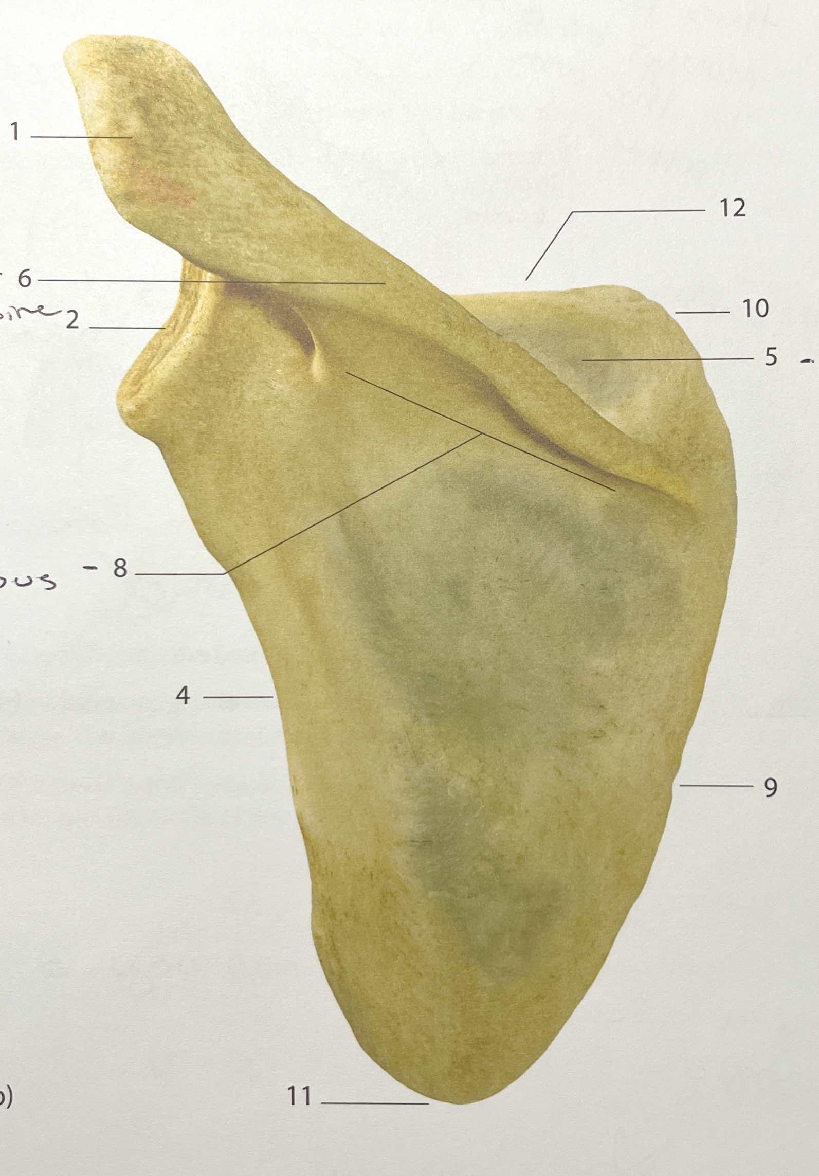 <p>#6</p>