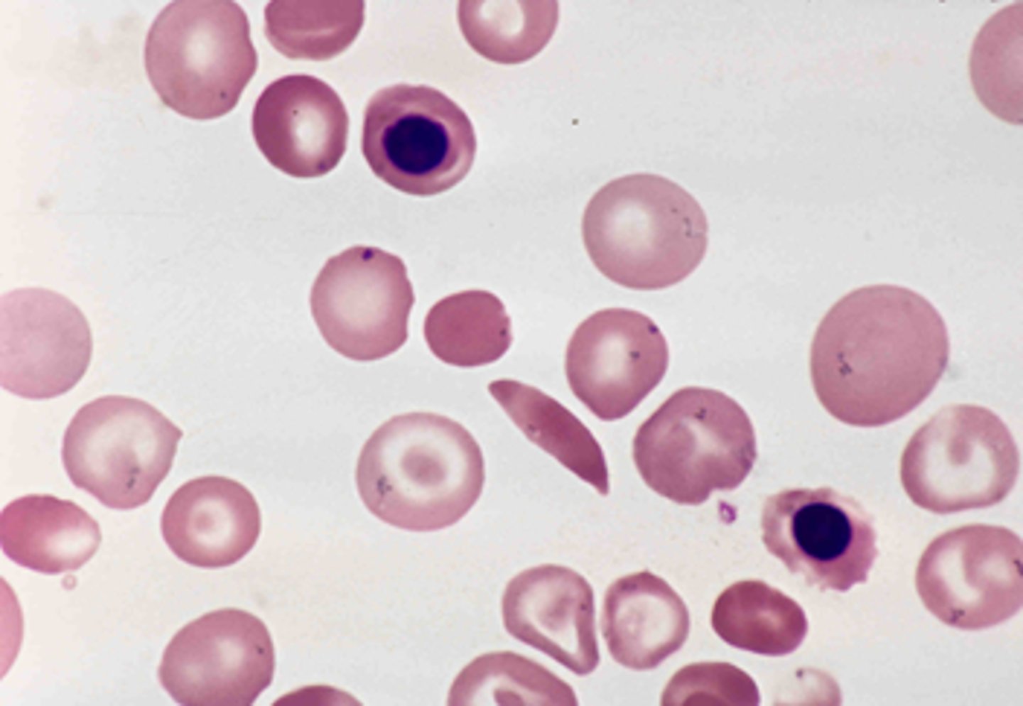 <p>Maintains recessive alleles in a population,</p>