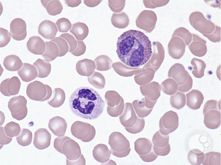 <p><u>Eosinophils</u> are <strong>larger and richer in color</strong> when stained, and typically are <strong>bi-segmented</strong> unlike neutrophils</p><p>R: Neutrophil L: Eosinophil</p>