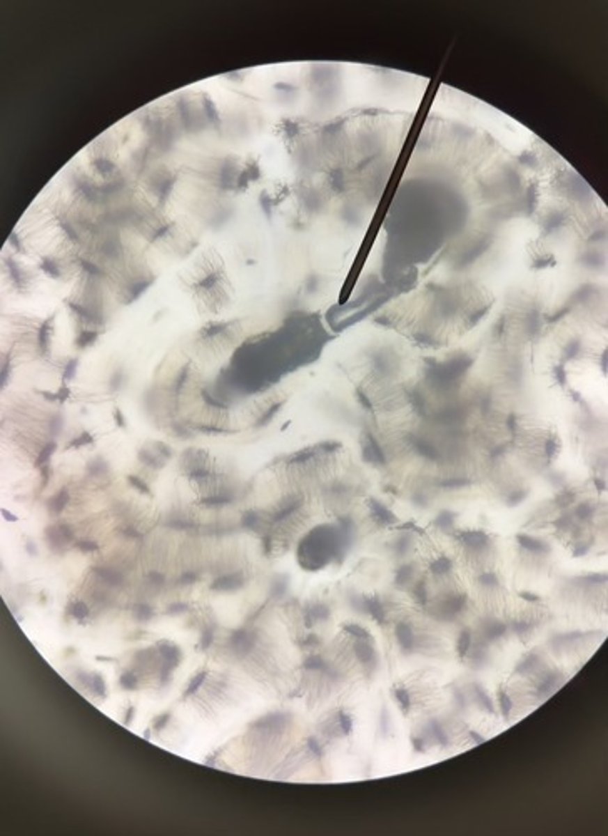 <p>1. What is the structure at the pointer?</p><p>2. What are the areas of hard bone matrix called?</p>