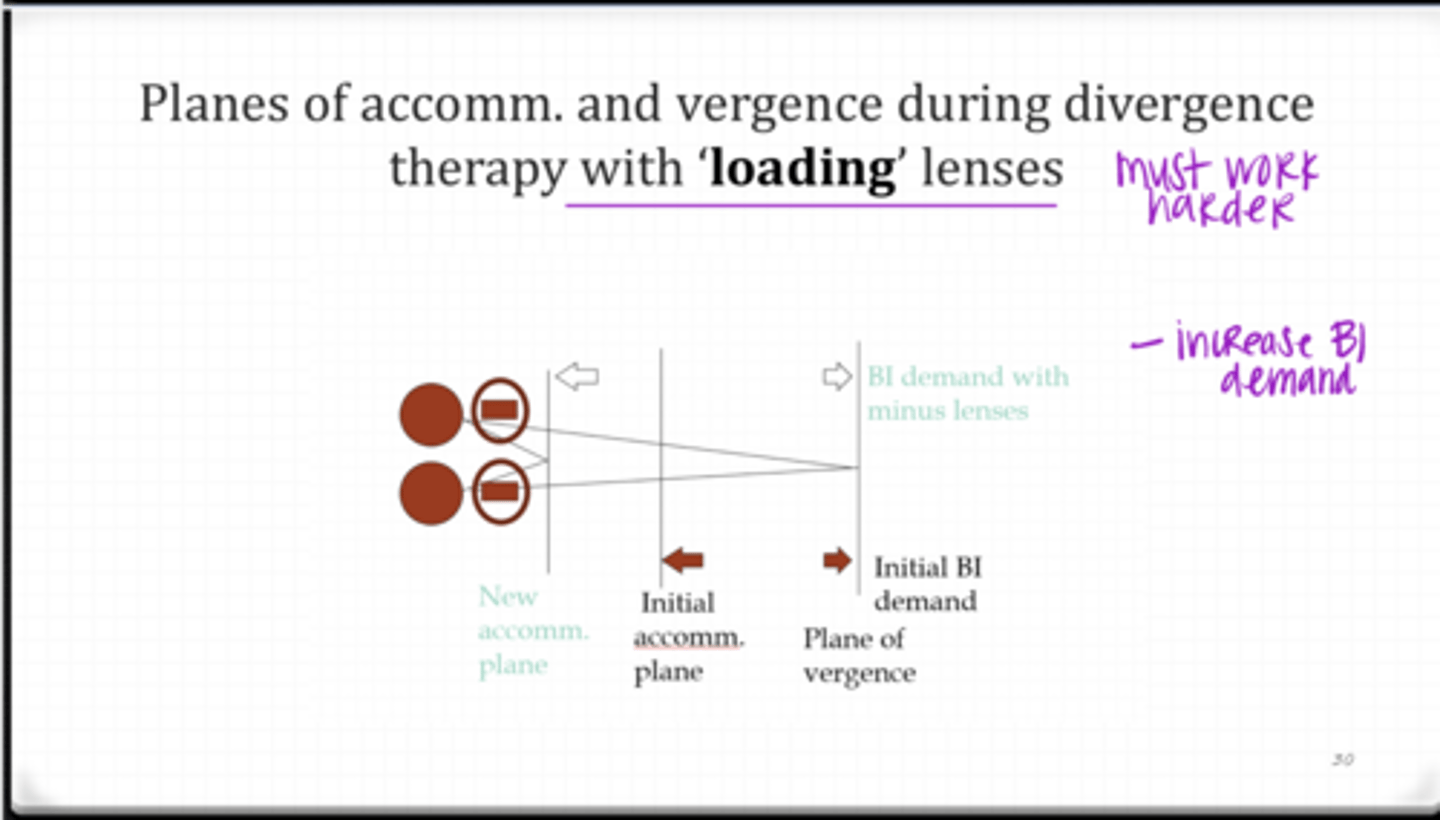 <p>What happens when minus lenses are added during Divergence Therapy?</p>